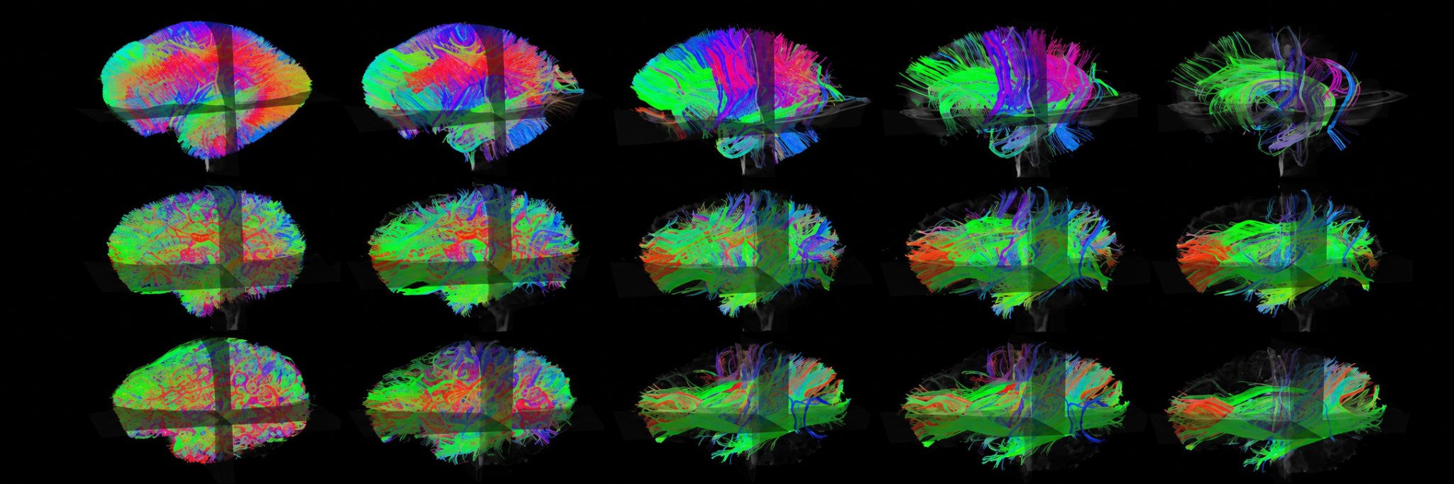 Seeing the brain in action