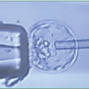 Transgenic and Genetically Engineered Models (TGEMs) Core