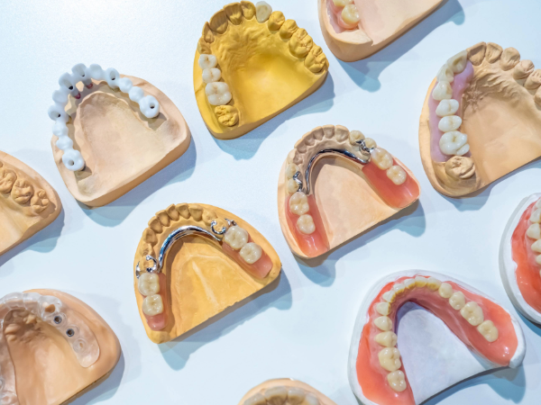 Adobe Stock image of teeth prosthesis