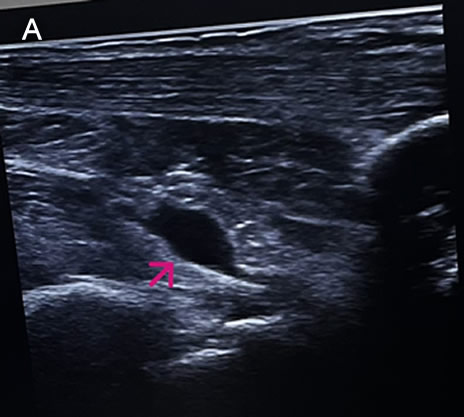 Image for Case 2025-11