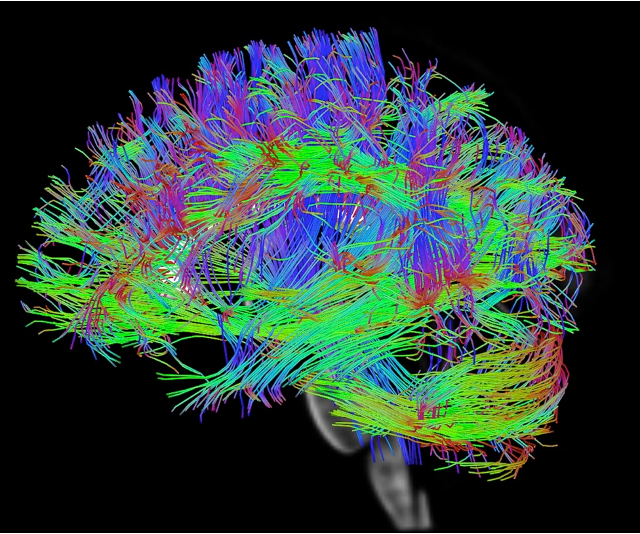 fuzzy brain imaging, colorful brain picture with a black background