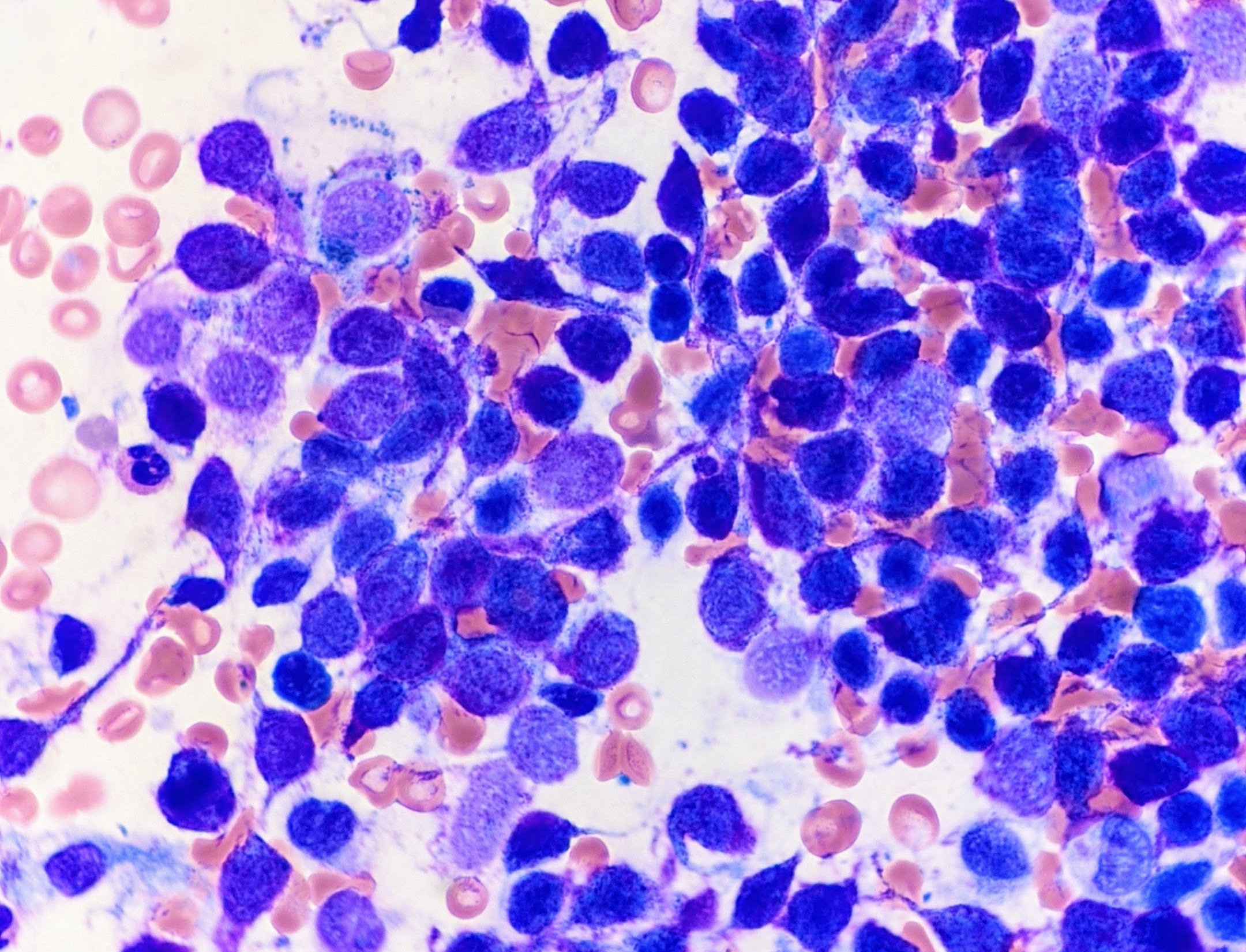 Aspirate.jpg