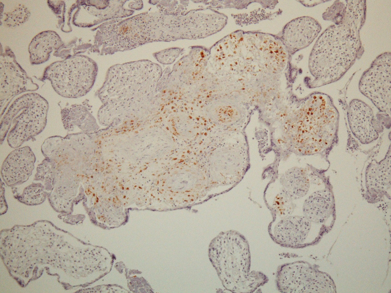 FIG 10 hsv immuno pos