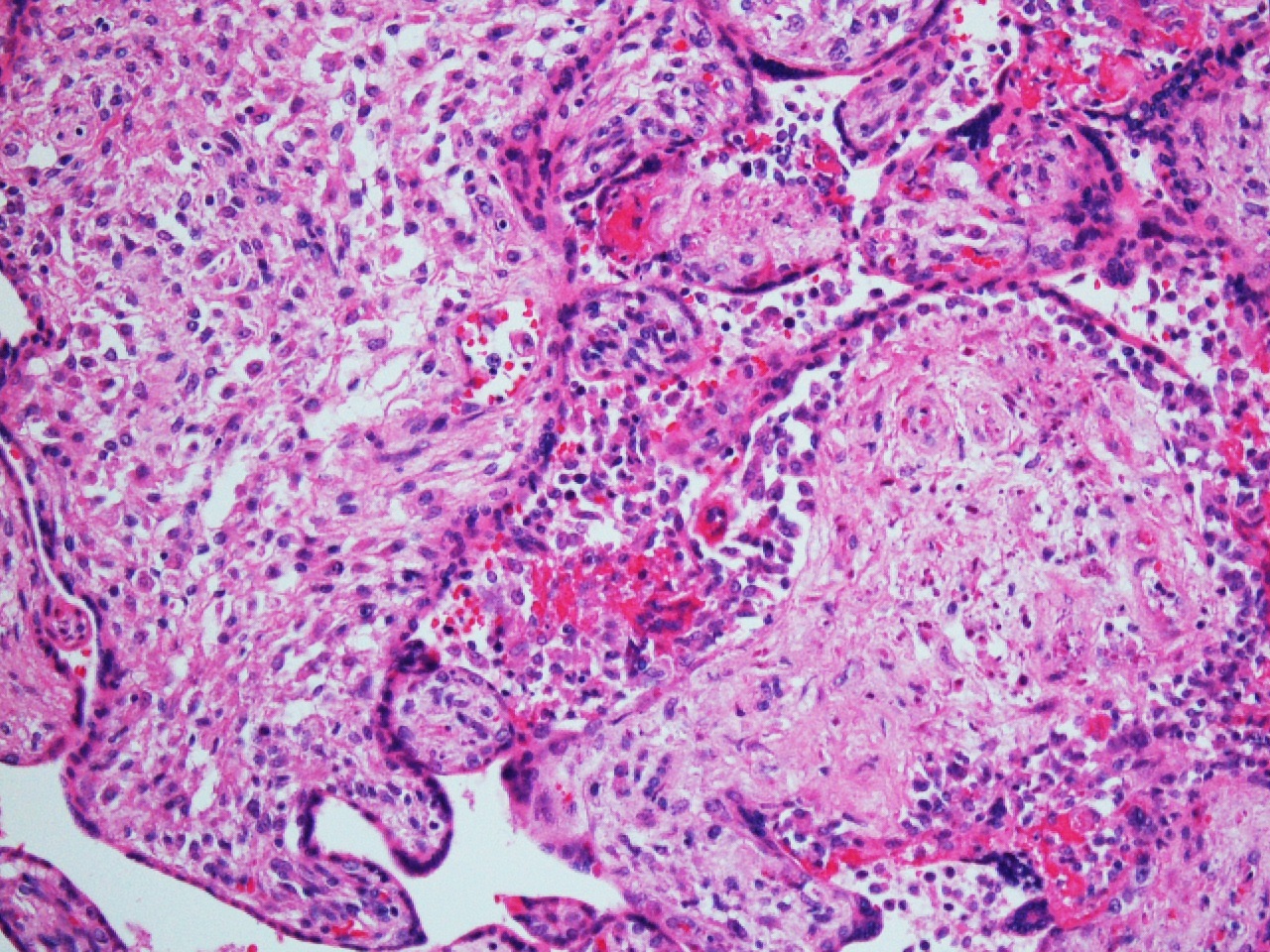 FIG 11 40x Toxo 1a 2