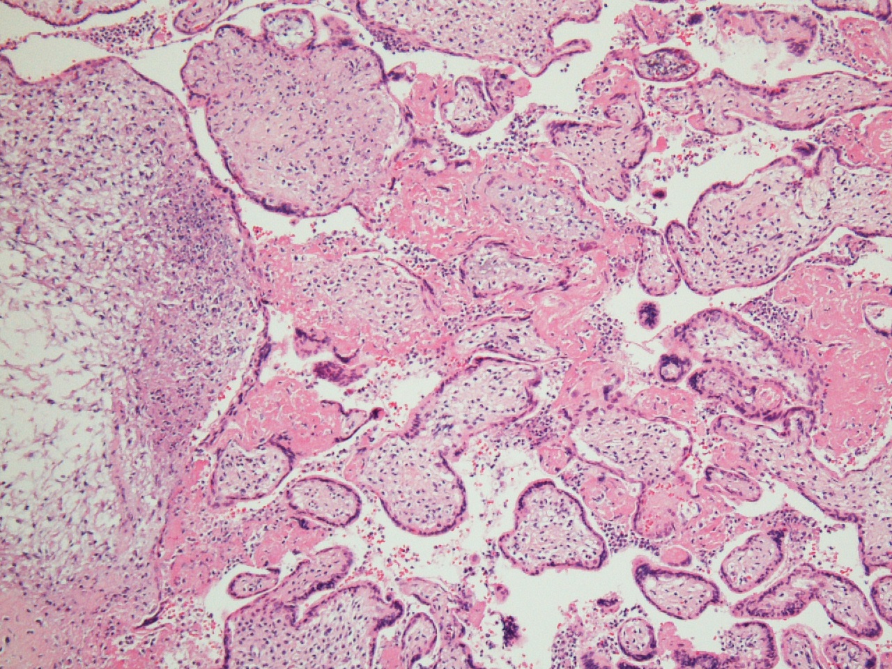 FIG 8 hsv 1a