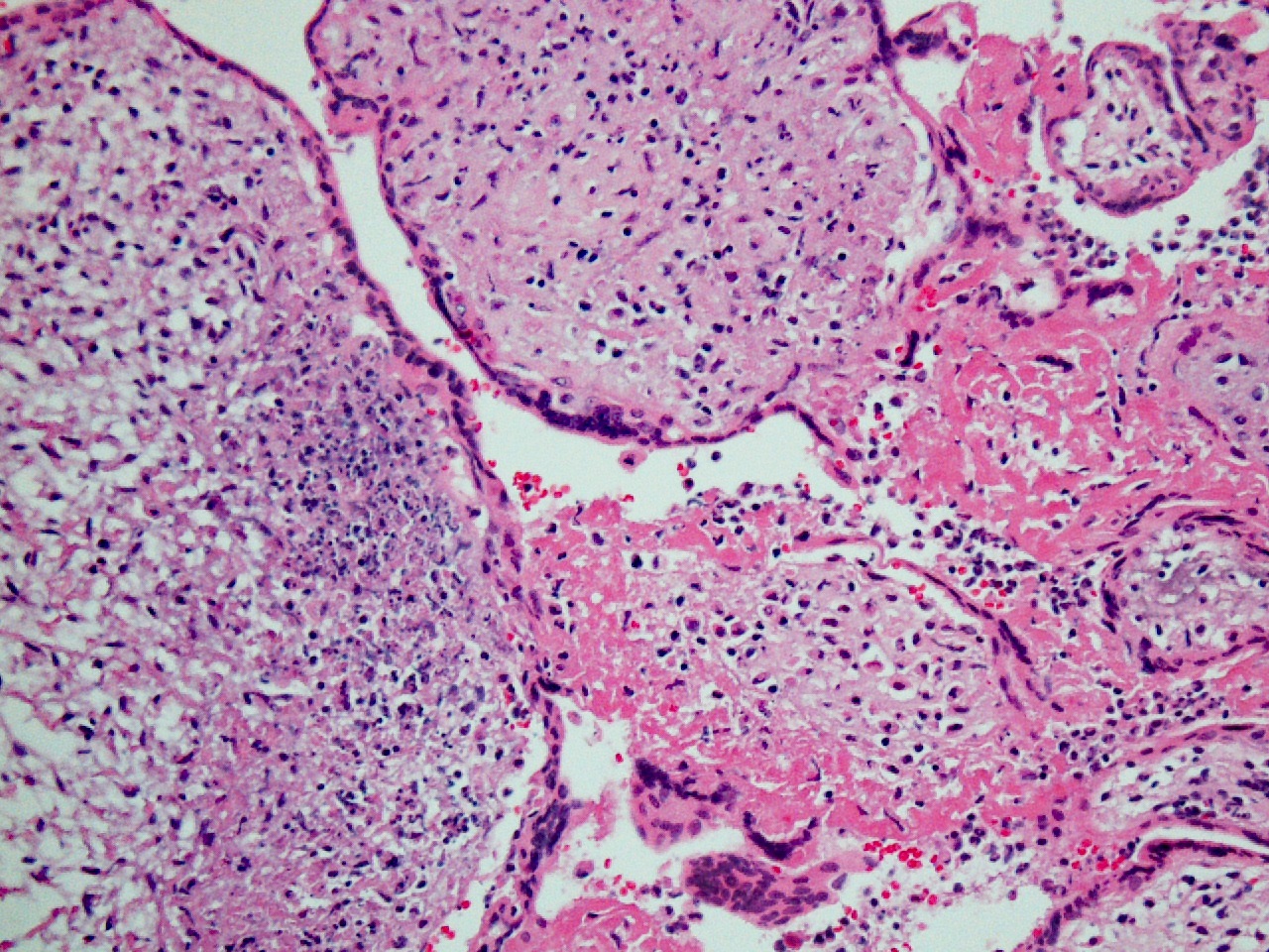 FIG 9 hsv 1
