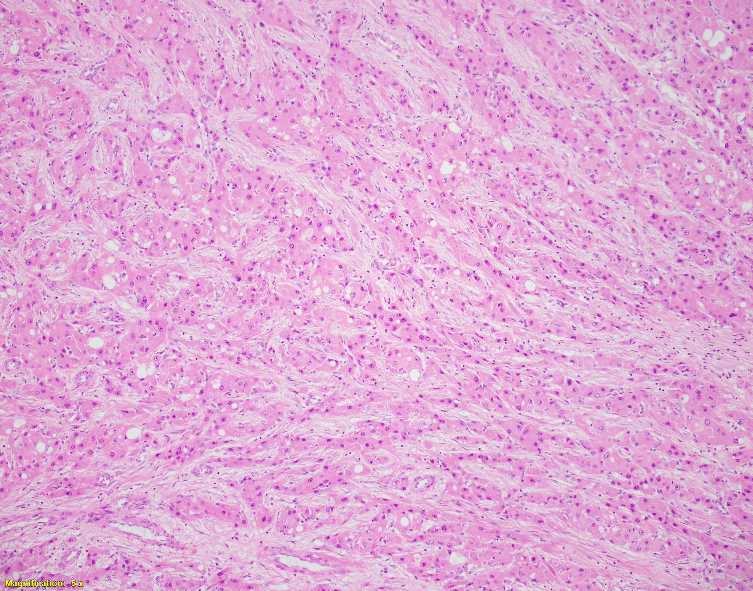 Case of the week 2
