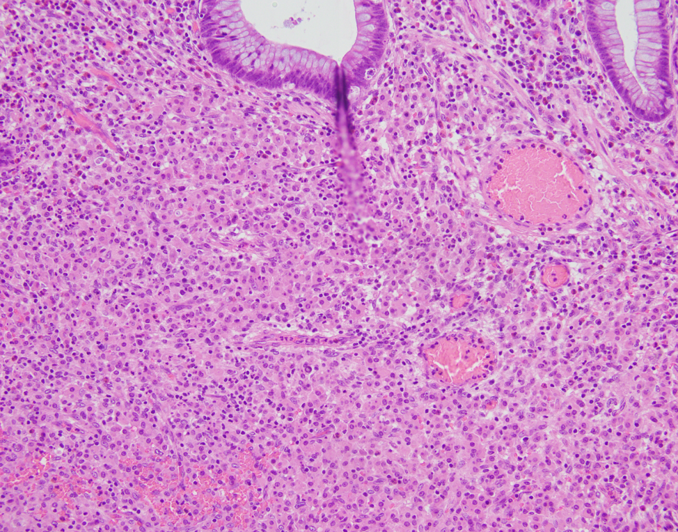 Case of the week 2