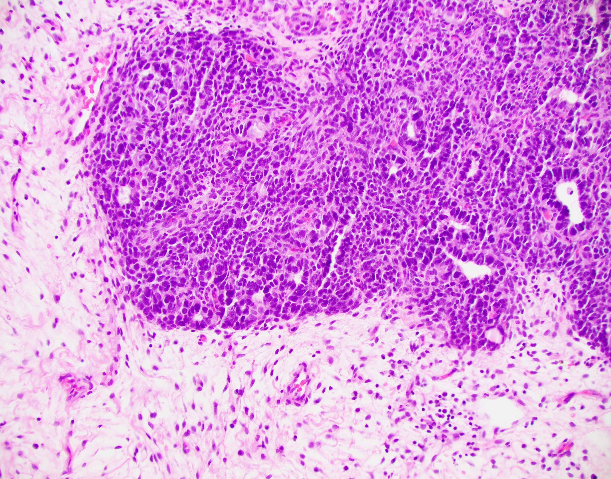 Case of the week 2