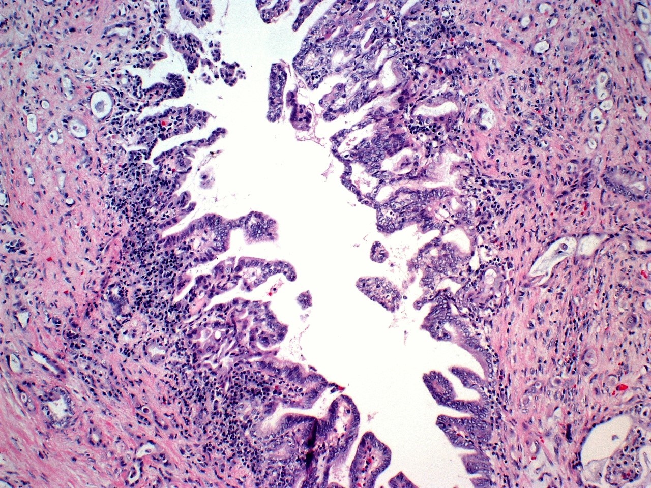 Picture1