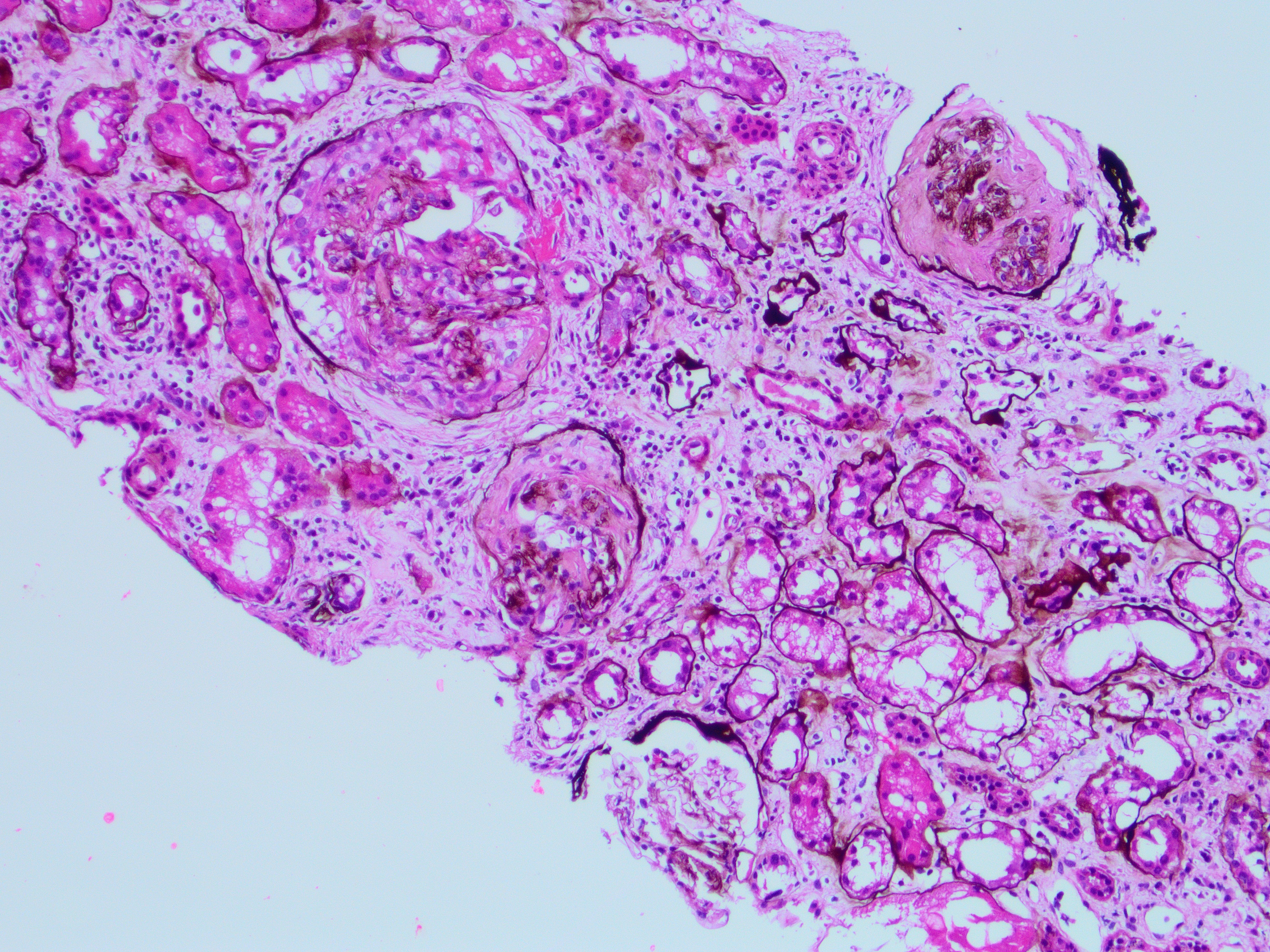 Fig A