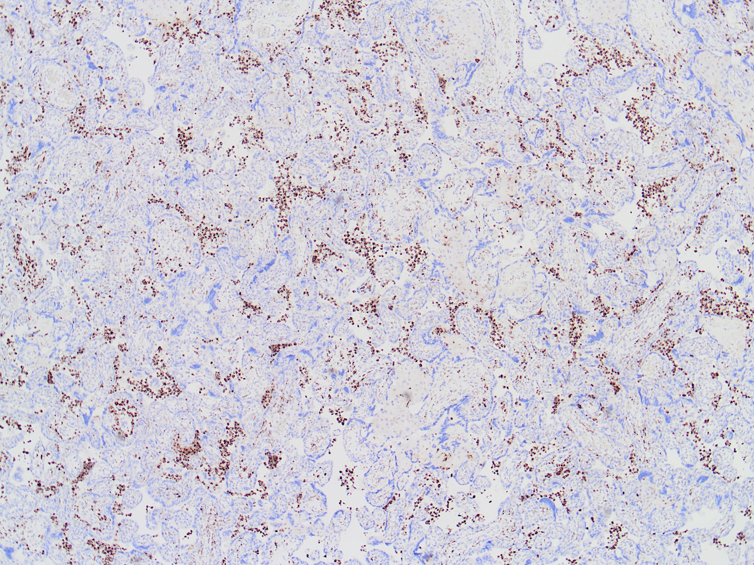 Answer MCI CD68 4x