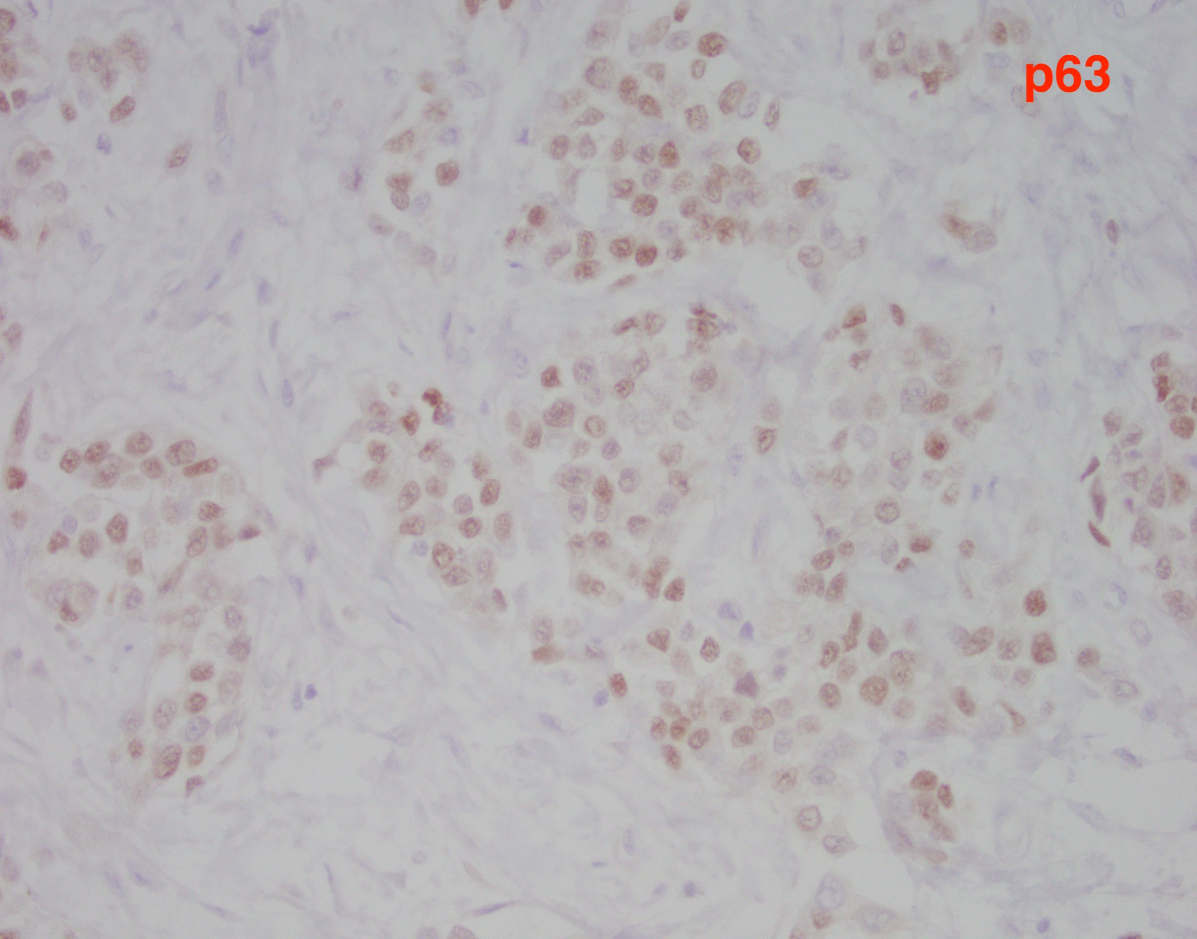PVUC p63