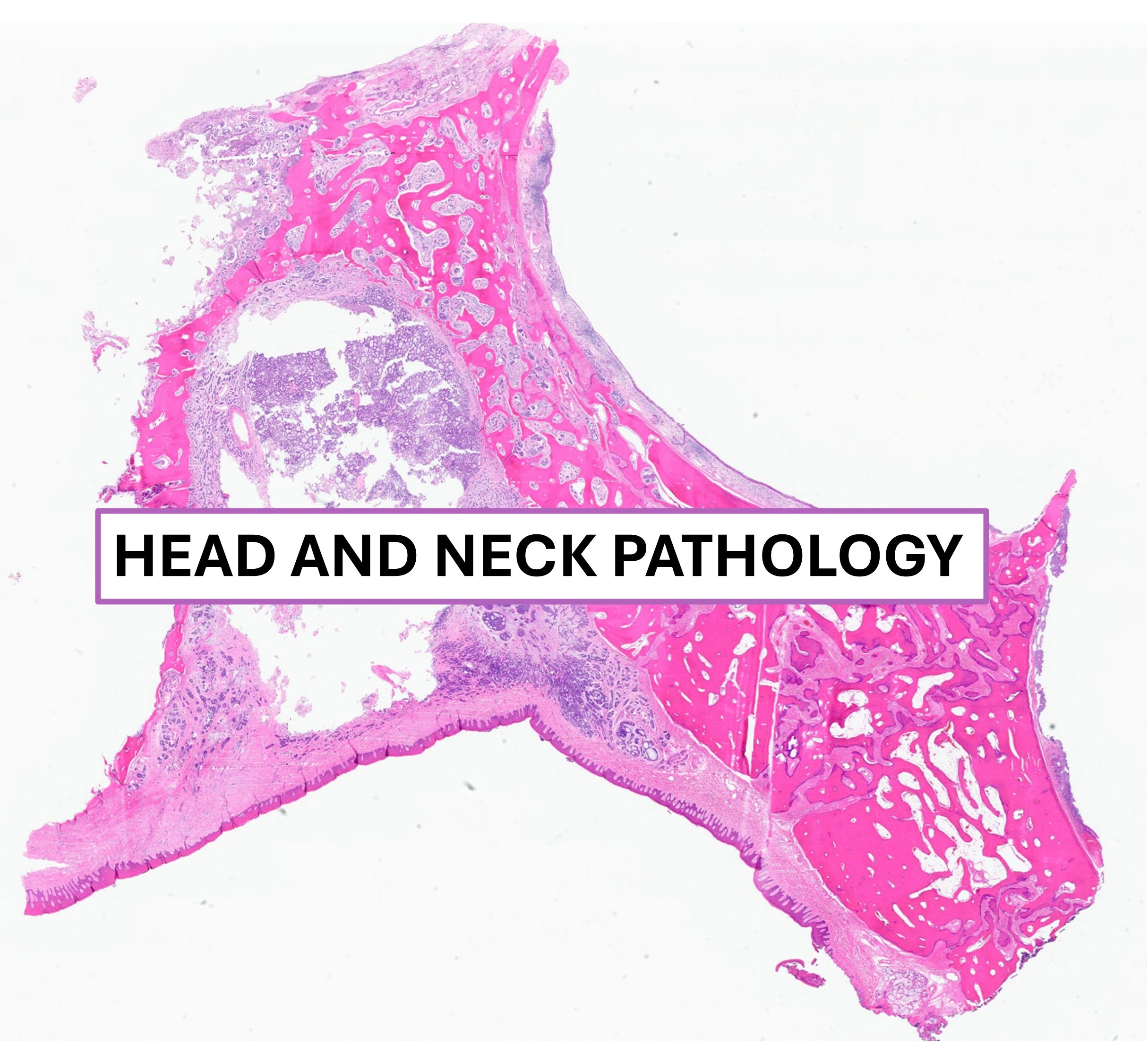 hn pathology