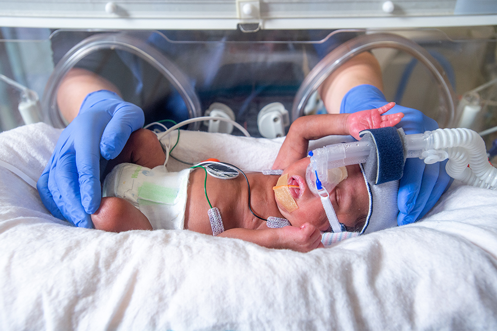 Regional Neonatal Intensive Care Unit & NICU at Children's of Alabama