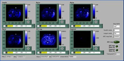 mri_research