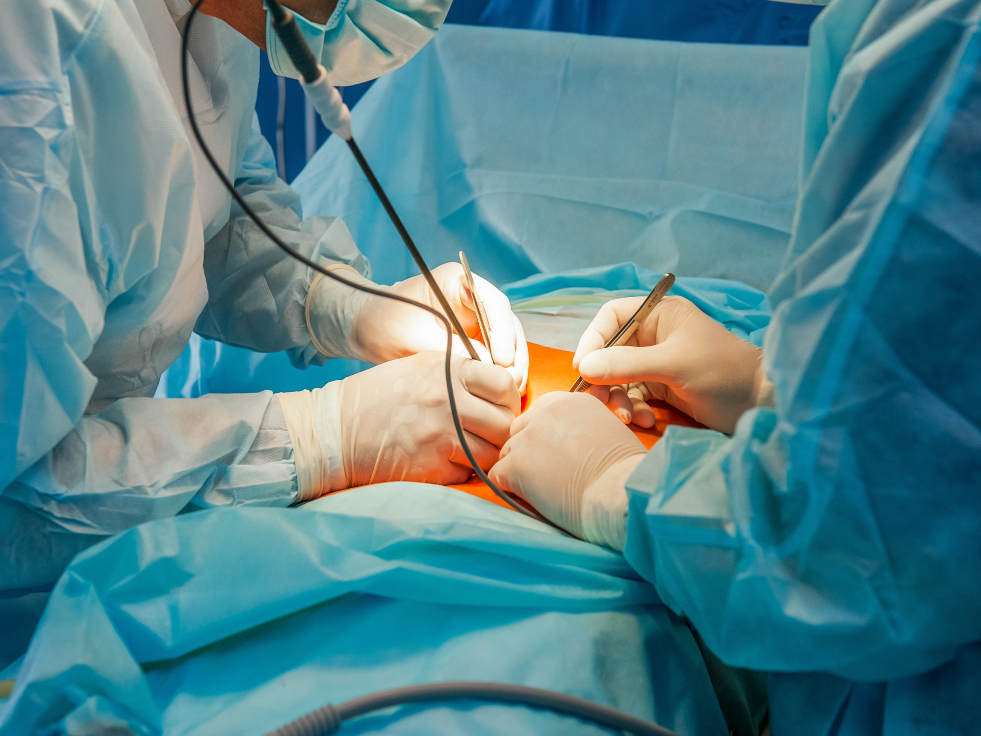 UAB GI Fellowship hernia designation