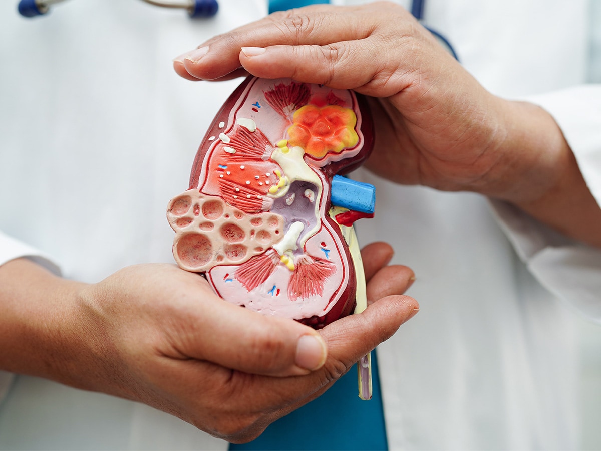 Image of someone in a a white doctors coat holding a detailed kidney model. 