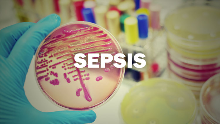 Reducing Sepsis Mortality