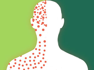 measles image 300