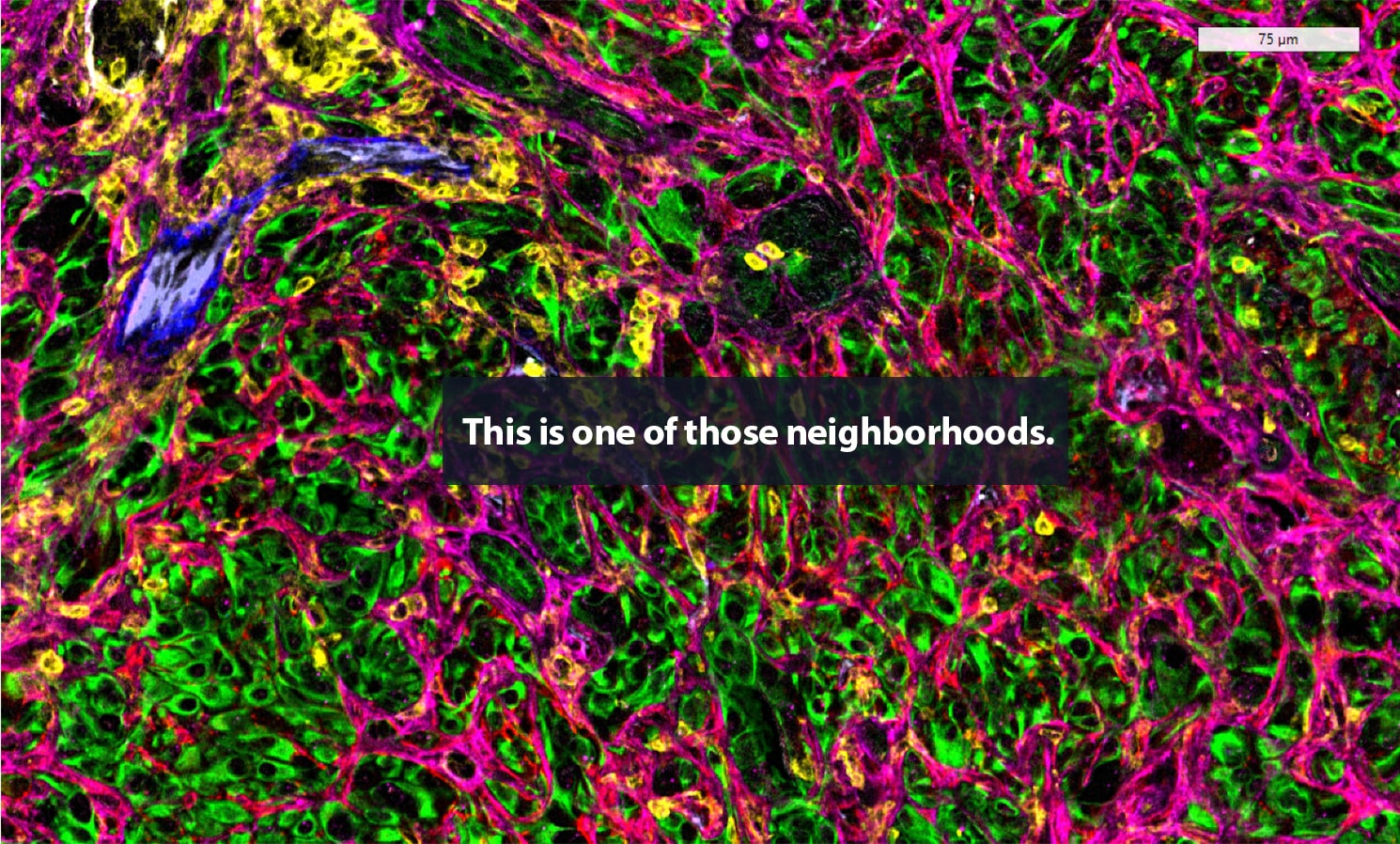 1 full stroma 1490x898px