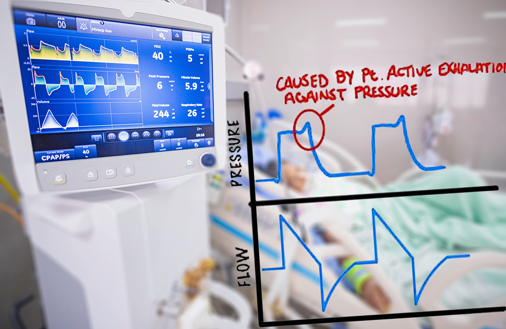 rep vent open composite 1000x650px